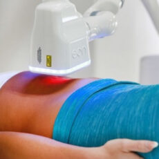 EON Laser procedure in action