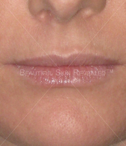 bna-sample